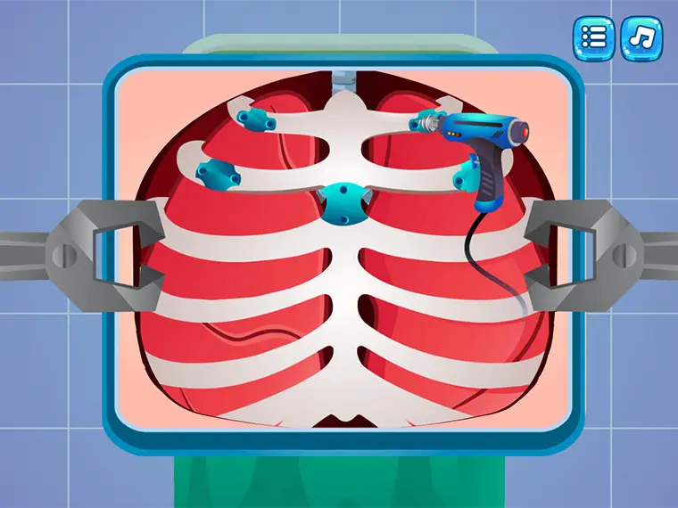 Lung Surgery