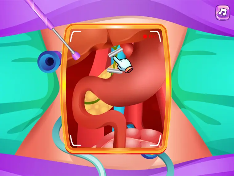 Princess Gallbladder Surgery